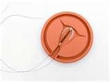 Pictures of Copper Wire Iud
