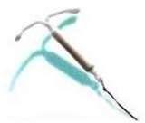 Pictures of Copper Wire Iud
