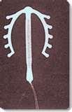 Copper Wire Iud Pictures Copper Wire Iud Pictures
