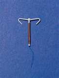 Copper Wire Iud Pictures