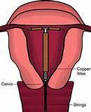 Pictures of Copper Wire Diagram Pictures of Copper Wire Diagram